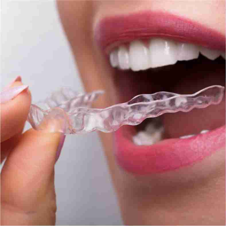 Dra. Lucía Laborde - Bruxismo dental - Férulas o protectores bucales