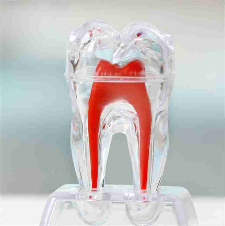 Dra. Lucía Laborde - Endodoncia - Acceso a la pulpa