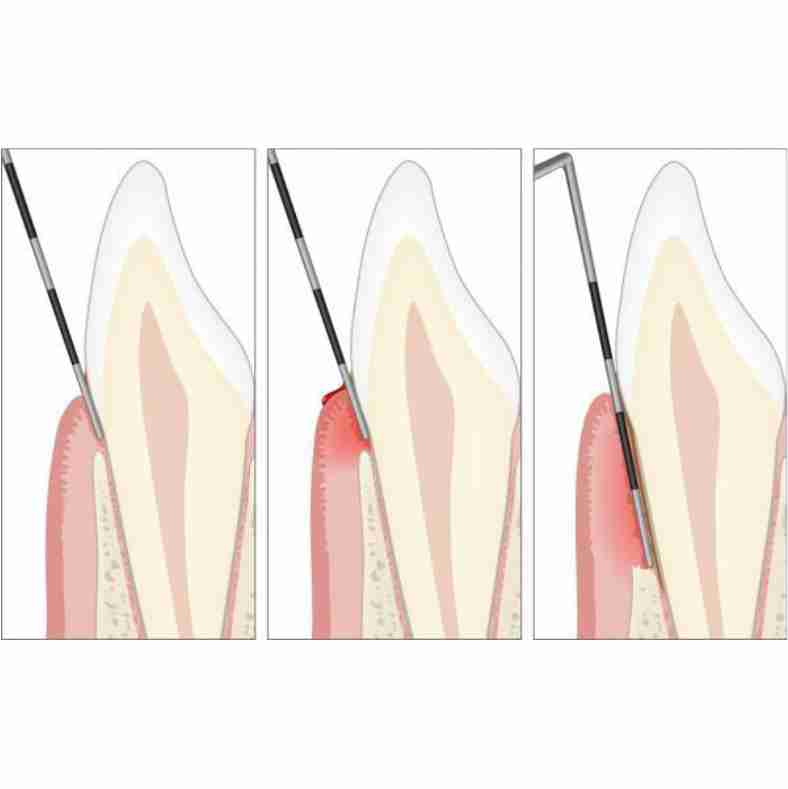 Dra. Lucía Laborde - Periodoncia - Evaluación y diagnóstico