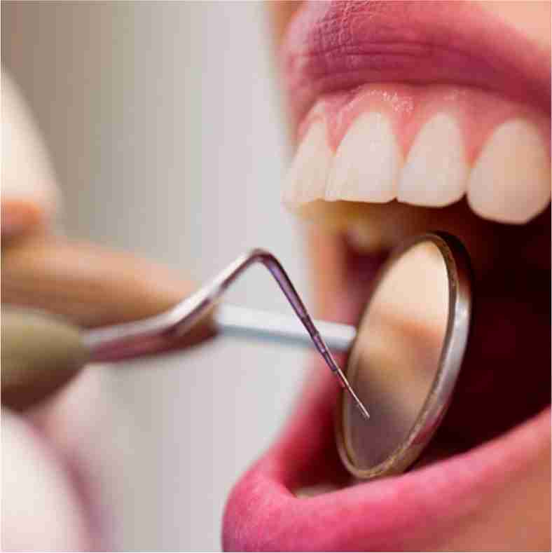 Dra. Lucía Laborde - Periodoncia - Mantenimiento periodontal