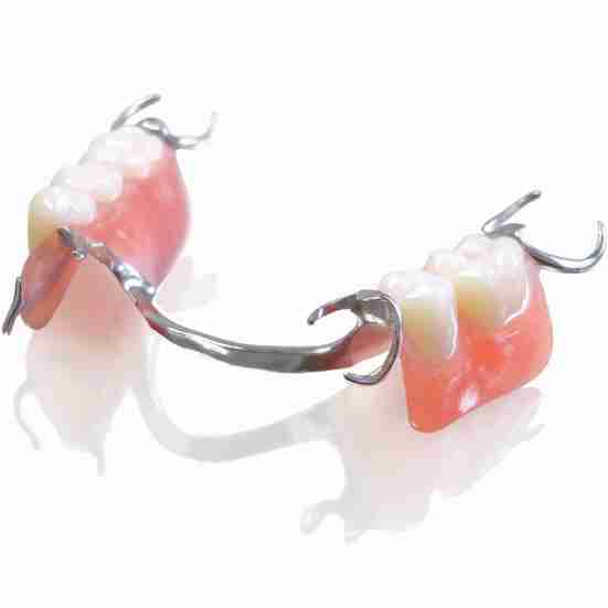 Dra. Lucía Laborde - Protesis dental - Prótesis parciales removibles