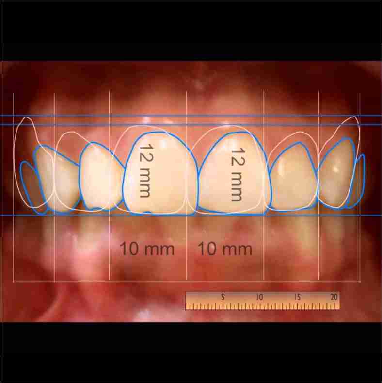 Dra. Lucía Laborde - Diseño sonrisas - Forma y tamaño de los dientes