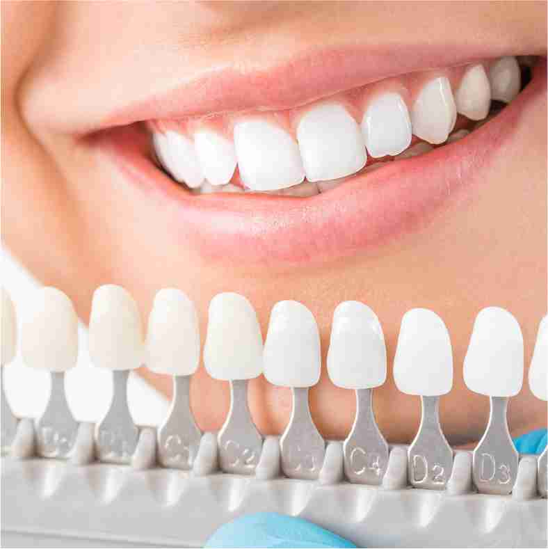 Dra. Lucía Laborde - Diseño sonrisas - Color de los dientes